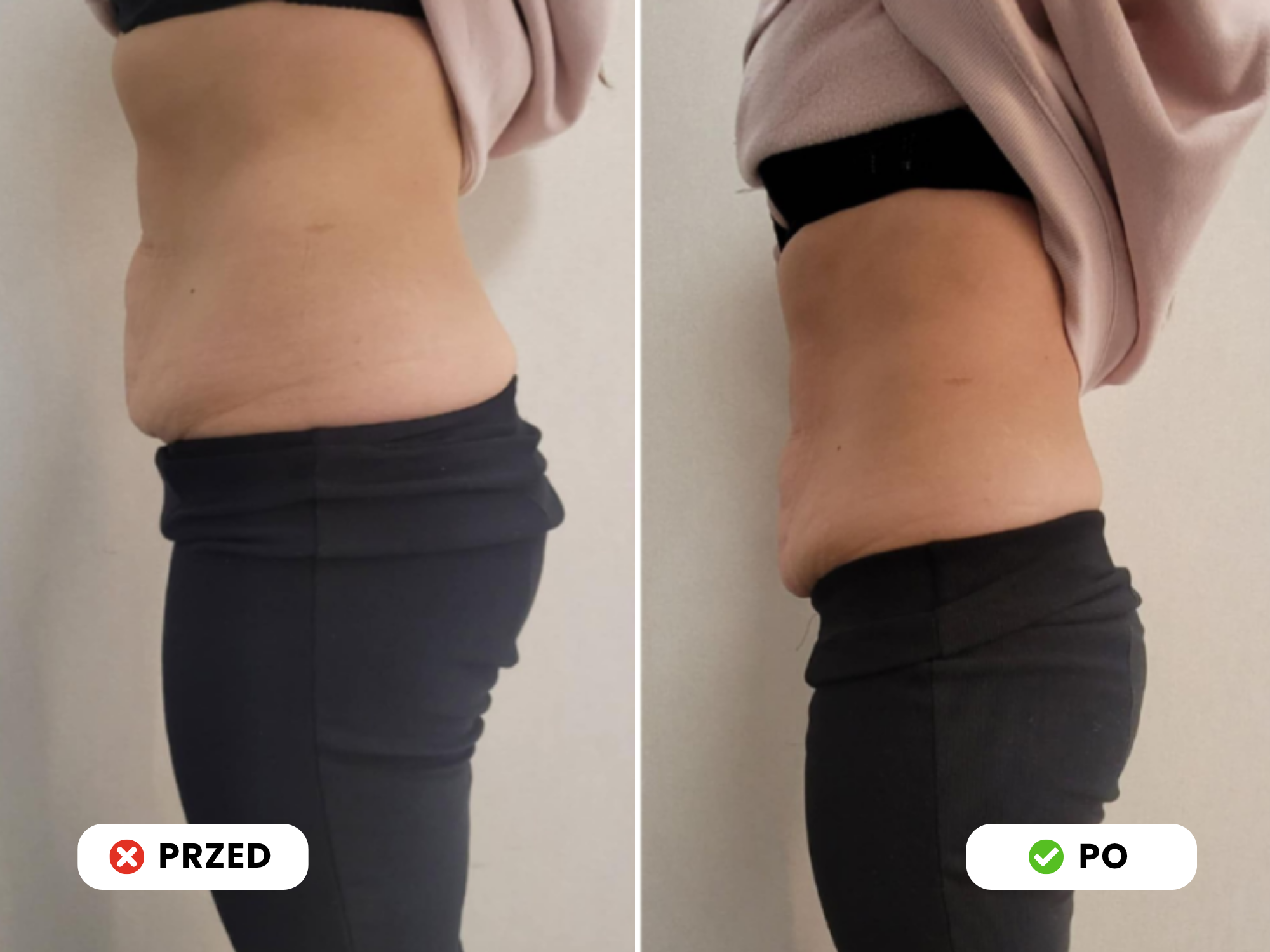 Przed_Po_2