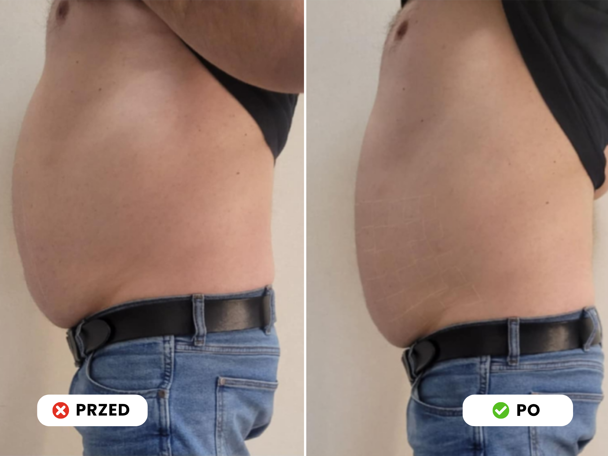 Przed_Po_5